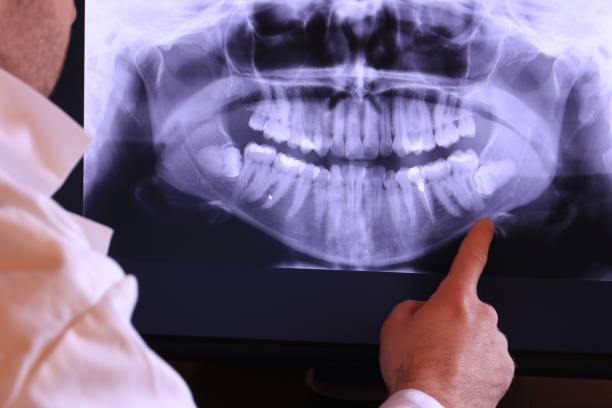 Best Broken Tooth Emergency  in Davenport, WA