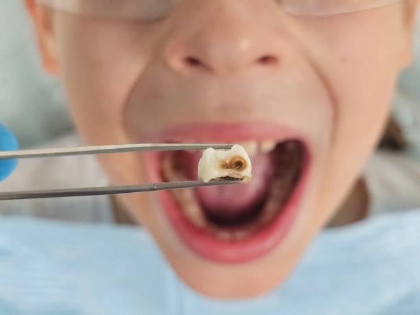 Best Emergency Gum Pain Relief  in Davenport, WA